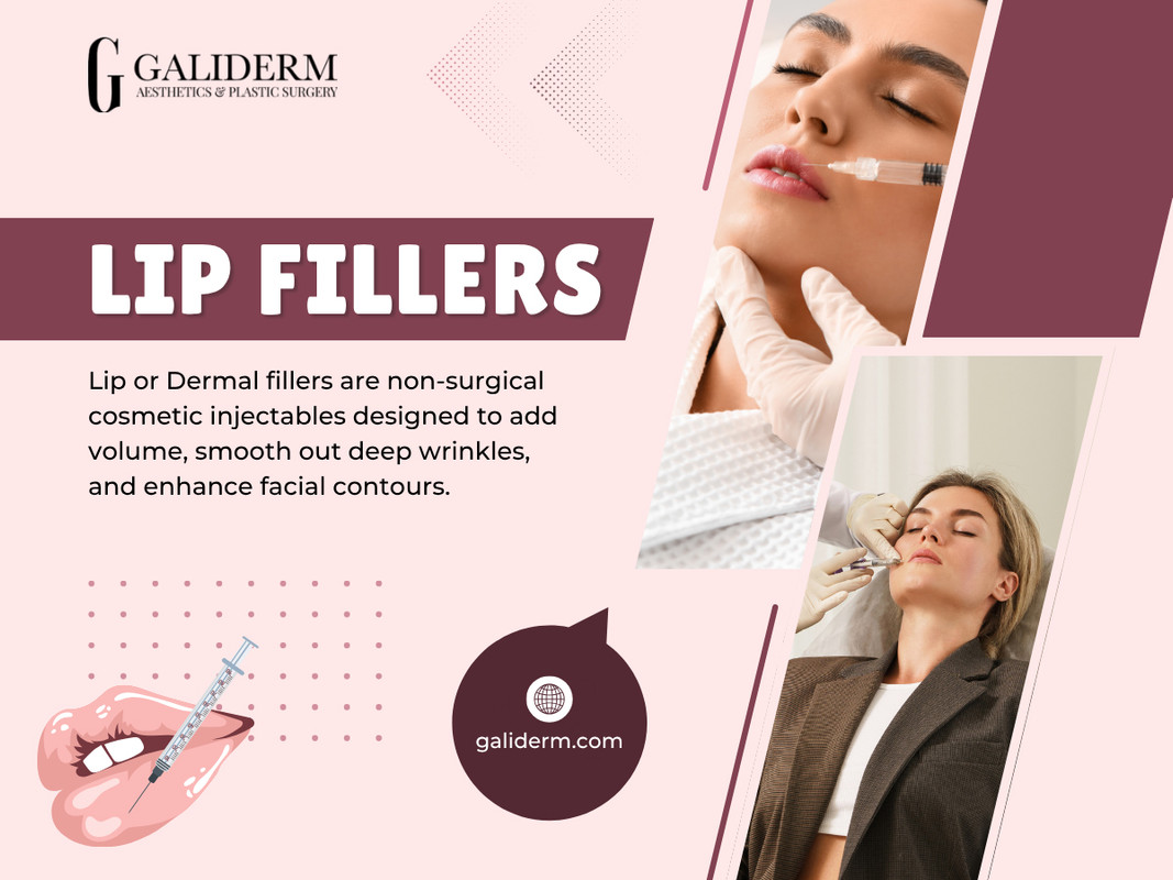 Lip Fillers