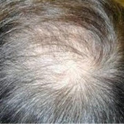 13920617015857361120194-400x400