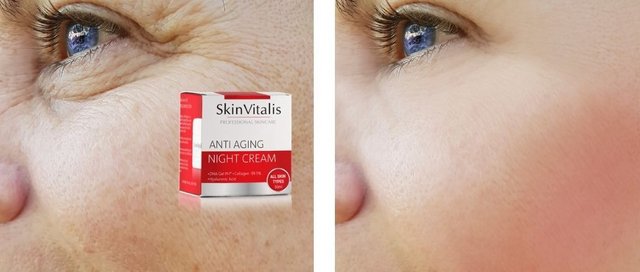 SkinVitalis sicuro ed efficace
