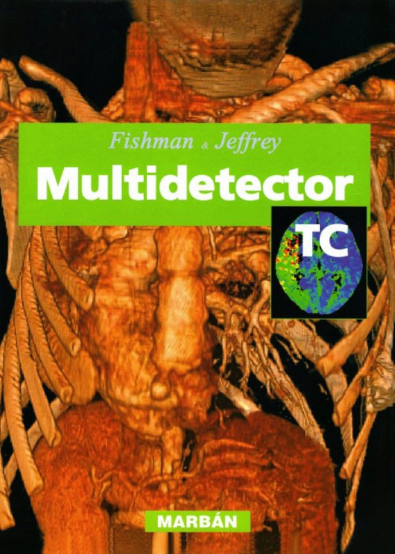 Portada de Fishman & Jeffrey Multidetector TC