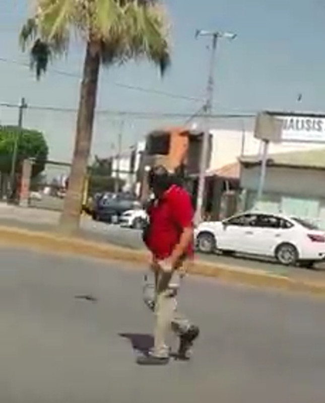 Hombre es atacado por aves zanates, le picotearon la cabeza y persiguieron