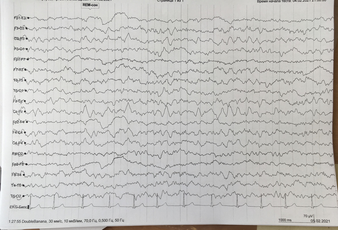 C5B95621-F32C-488C-8BA9-C9919FC23DB5