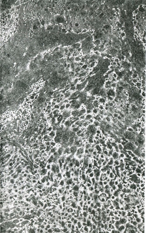 p0003