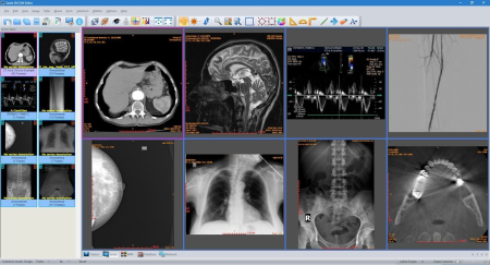 Sante DICOM Editor 8.1.7