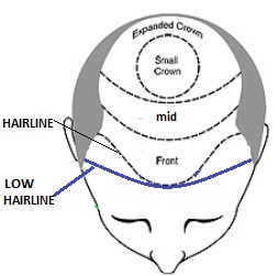 zone-scalpo-con-nomi-indicati