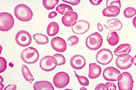Hematology question 6 image