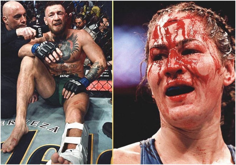 Конър Макгрегър с дълга почивка след UFC 264