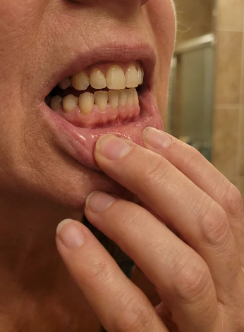 Day 1