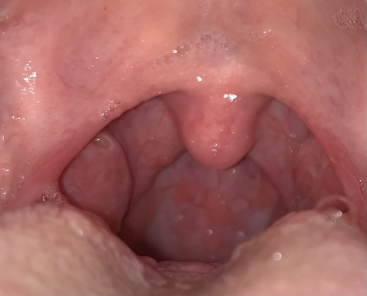 42E4514C-943A-449C-A215-0D68488D20EA