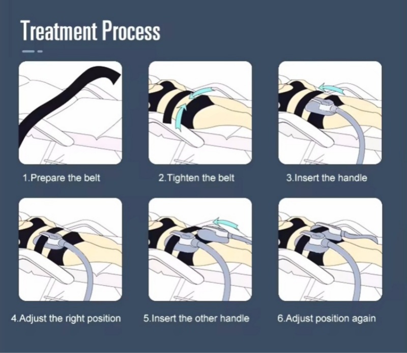 Device with 4 treatment heads