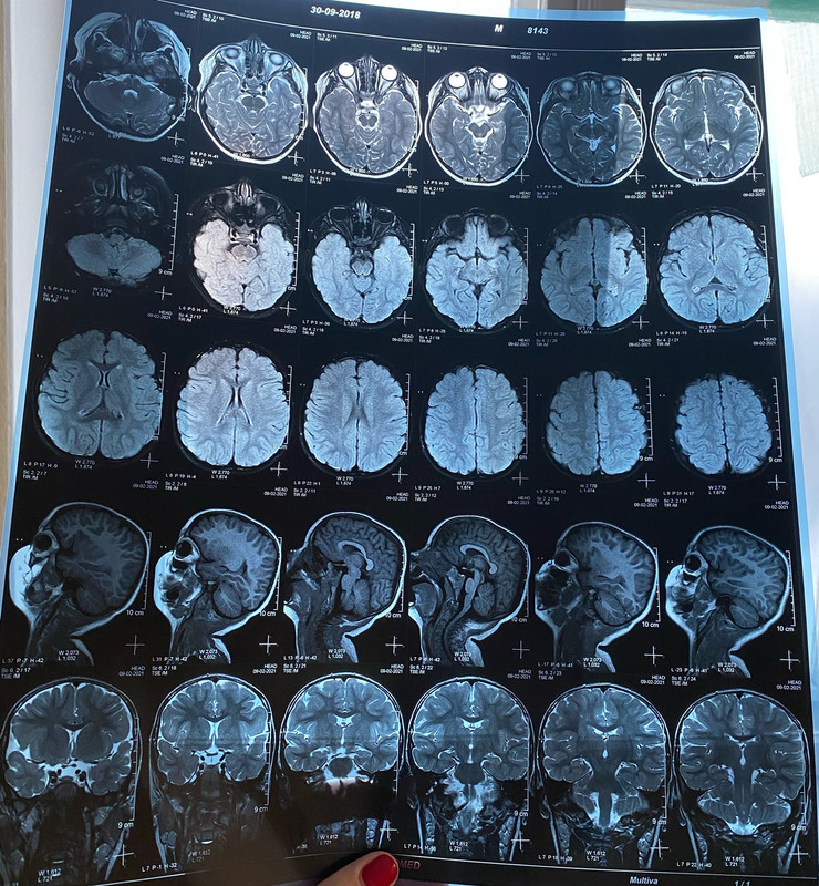 4BDA698E-E72D-45B8-B313-888F0E393B04