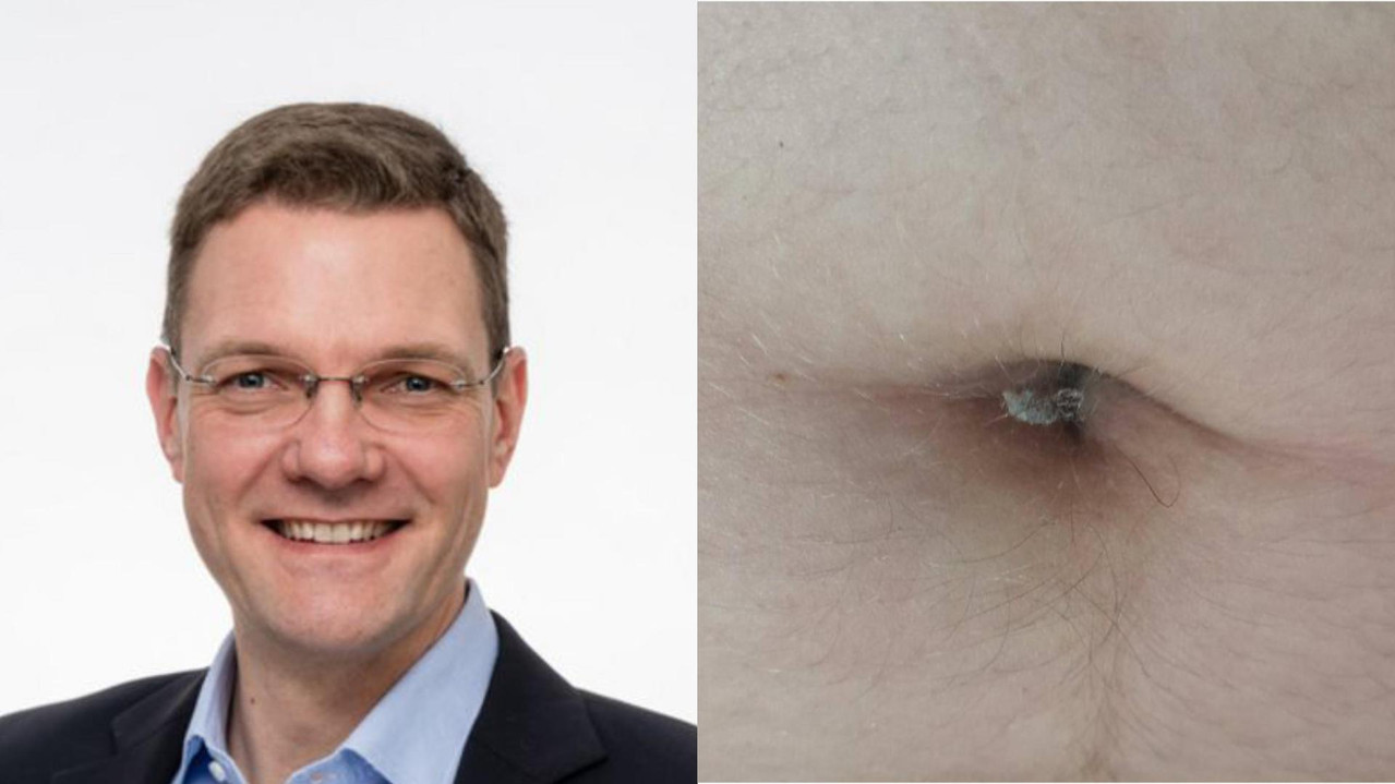belly-button-lint