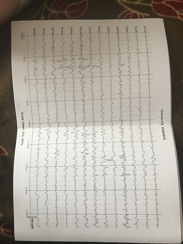 4E0DF010-B55F-43D4-891D-0FBF1357E2CE