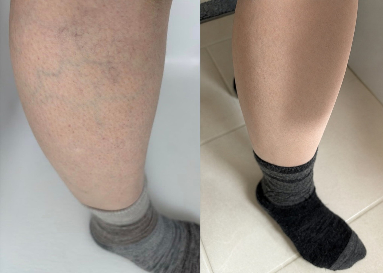 Depoimento VENACIL 2