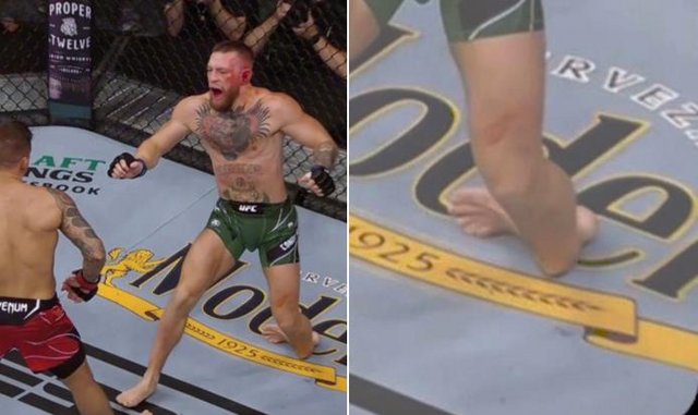 Lesión y derrota para McGregor Lesión y derrota para McGregor