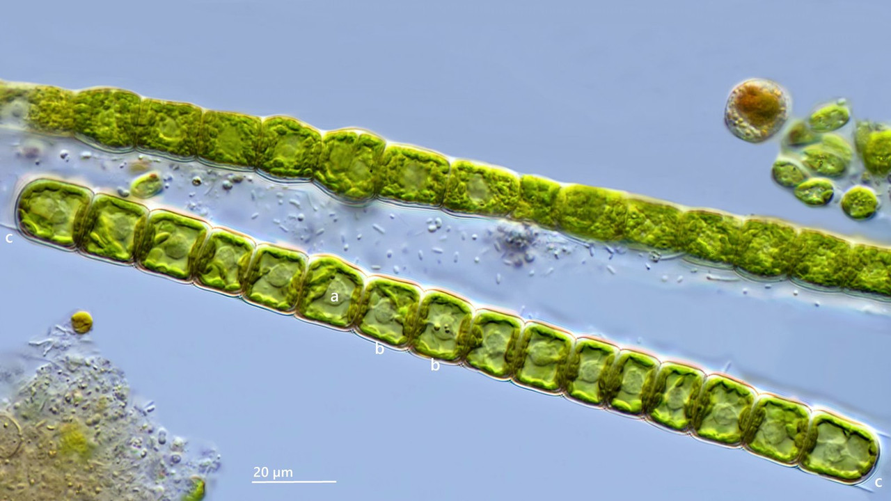 Microspora 17 (ev) floccosa oder wittrockii Doppelbecher-Alge H-Stücke am Ende DIK 100 Stack 4