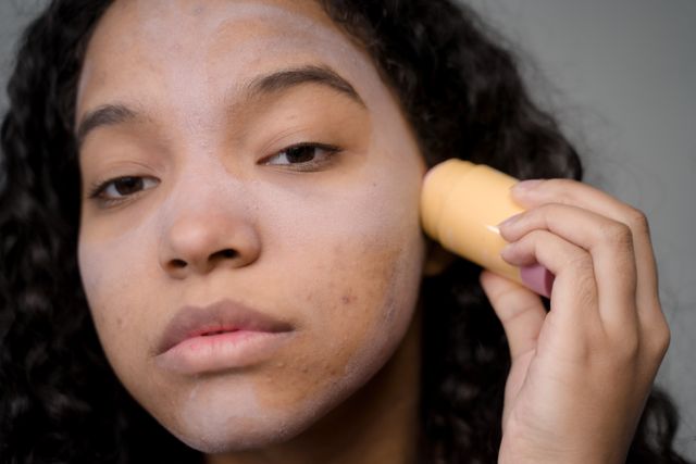 a woman applying makeup on her skin with various skin conditions like acne, dehydration, and open pores; that's why her makeup looks cakey and patchy. 