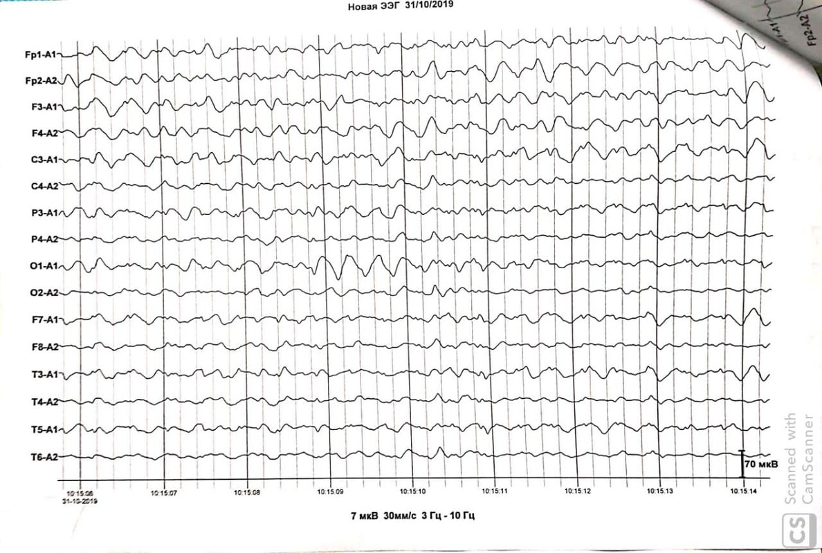 WhatsApp Image 2019-10-31 at 13.02.58(4)