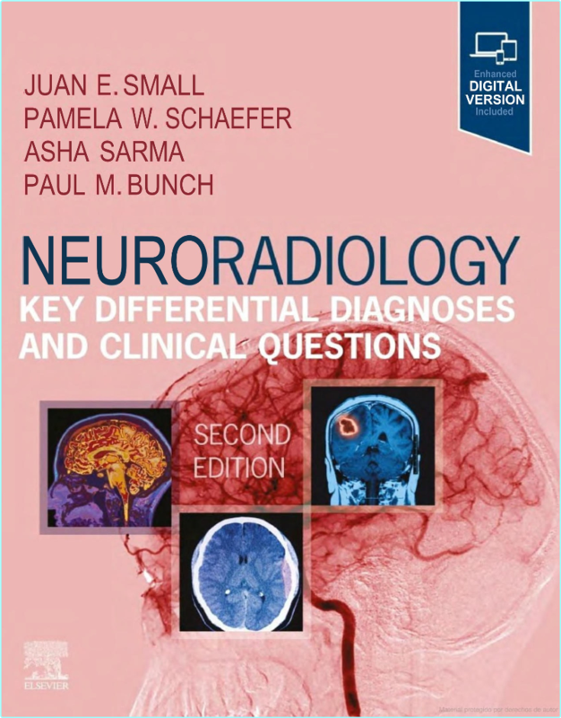 Neuroradiology Key Differential Diagnoses Clinical Questions 2ed (2024) (Mary Jo Goolsby)