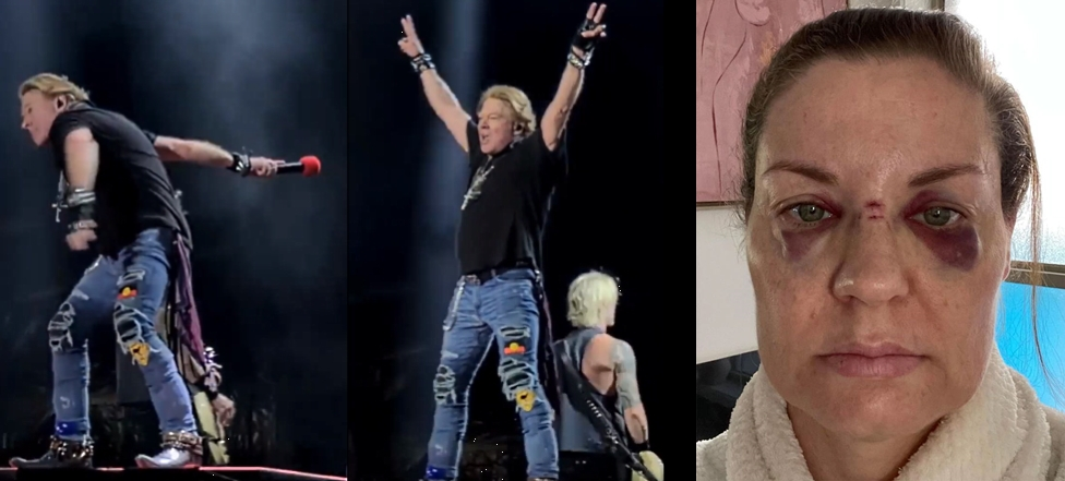Axl Rose de Guns N´ Roses golpea en el rostro a una fanática
