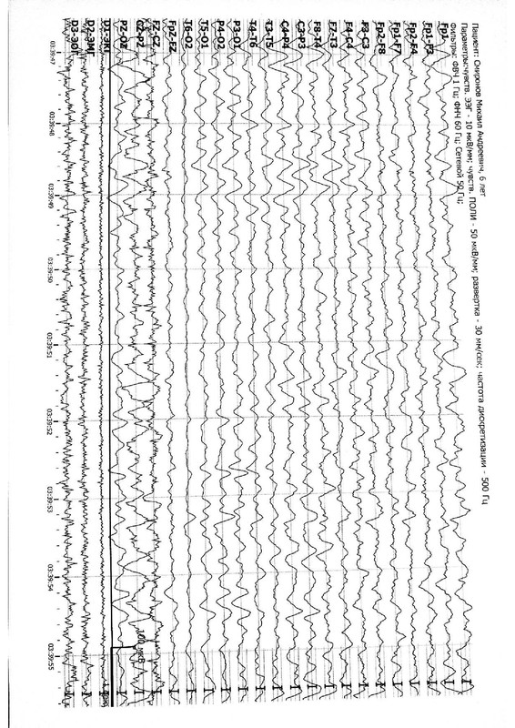 963873294b80479d965a30243f1151787COgqKfaoS7IG2sk-6