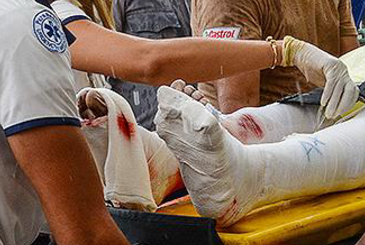 гипс - увелич