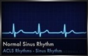 normal sinus rhythm