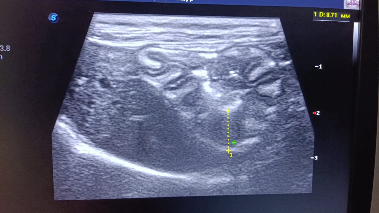 989BAC58-F05C-4DE3-8AA4-06D90B70AFB1