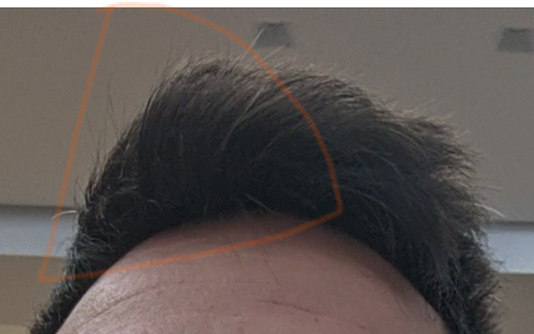 12. Dicembre 2020. Mi potevo permettere questo taglio qua. Il ciuffetto evidenziato era esistente. N