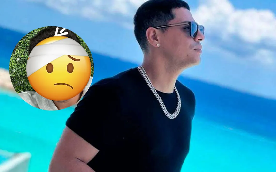 Totalmente ebrio, Eduin Caz sufre accidente, termina con heridas en la cara