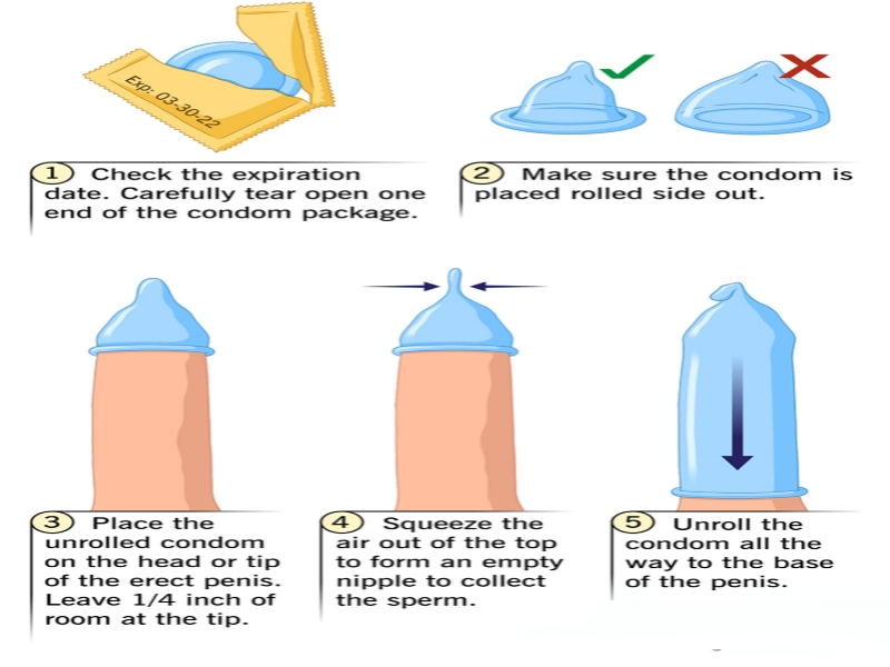 How to put on a condom infographic