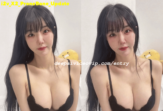 231_181_i2v X2 Prone Bone Update 1