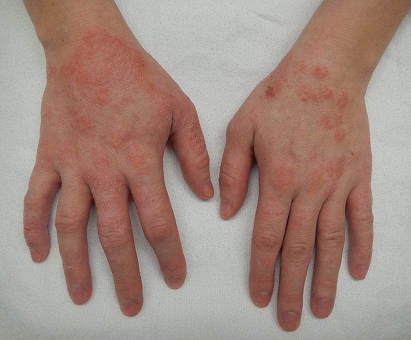 Dermatology question 3 image