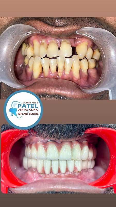 Patel Dental Clinic - Advanced dental equipment