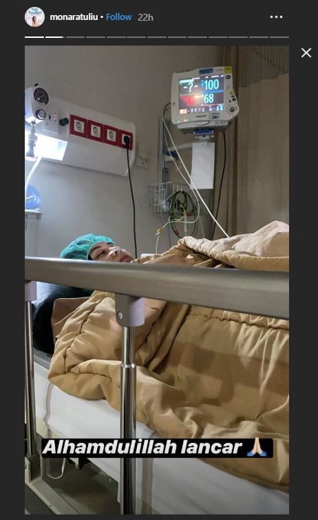Kesha Ratuliu telah menjalani operasi pengangkatan tumor