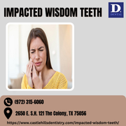 IMPACTED WISDOM TEETH