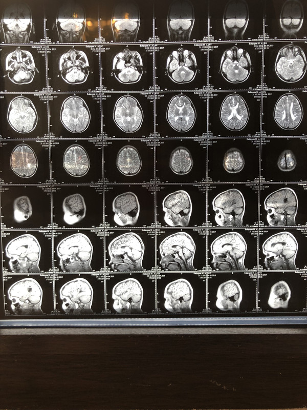 0291DFEA-216B-4438-8FEC-E70BED65798E