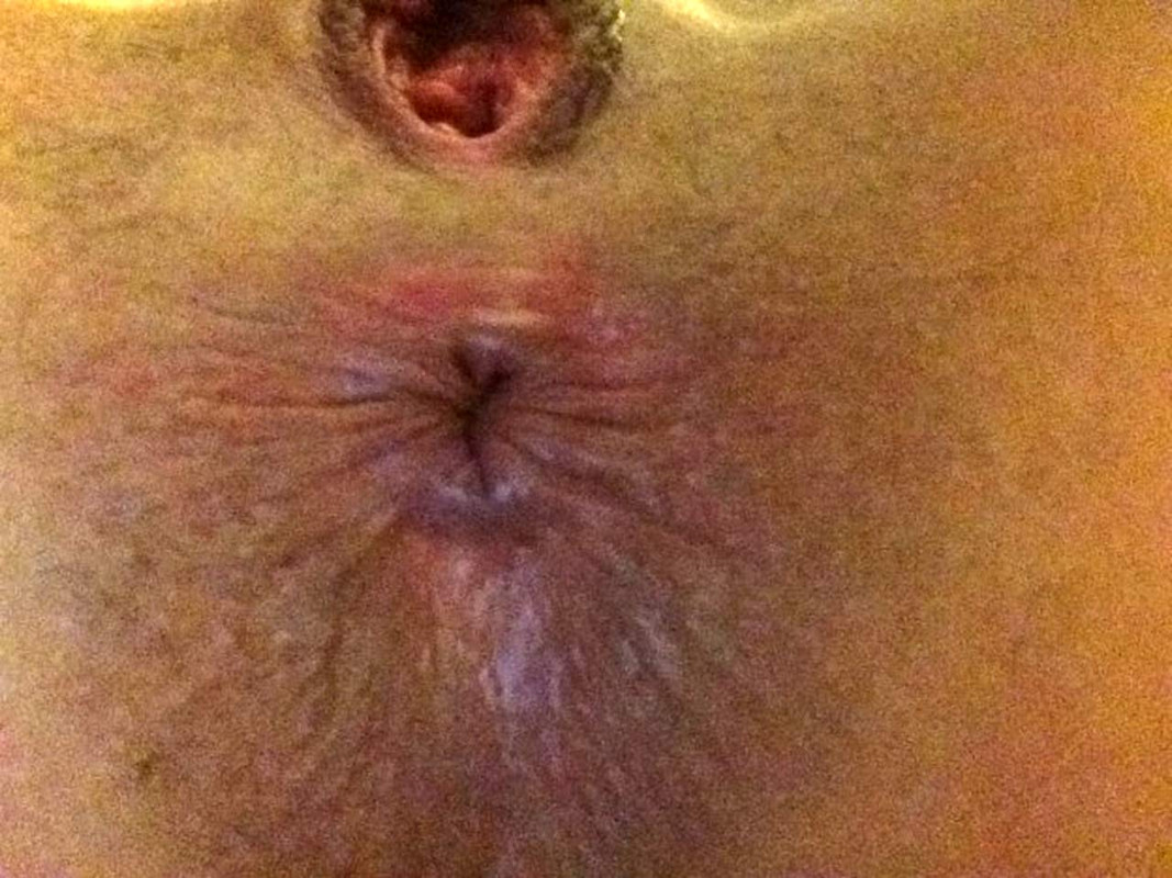 Hope-Solo-nude-leaked-naked-sexy-pussy-nipples-asshole-Scandal-Planet15-optimized