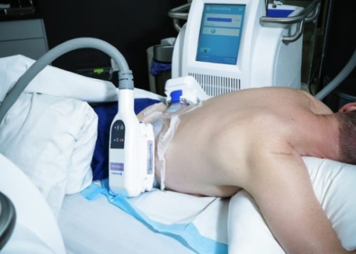 Cryolipolysis near me