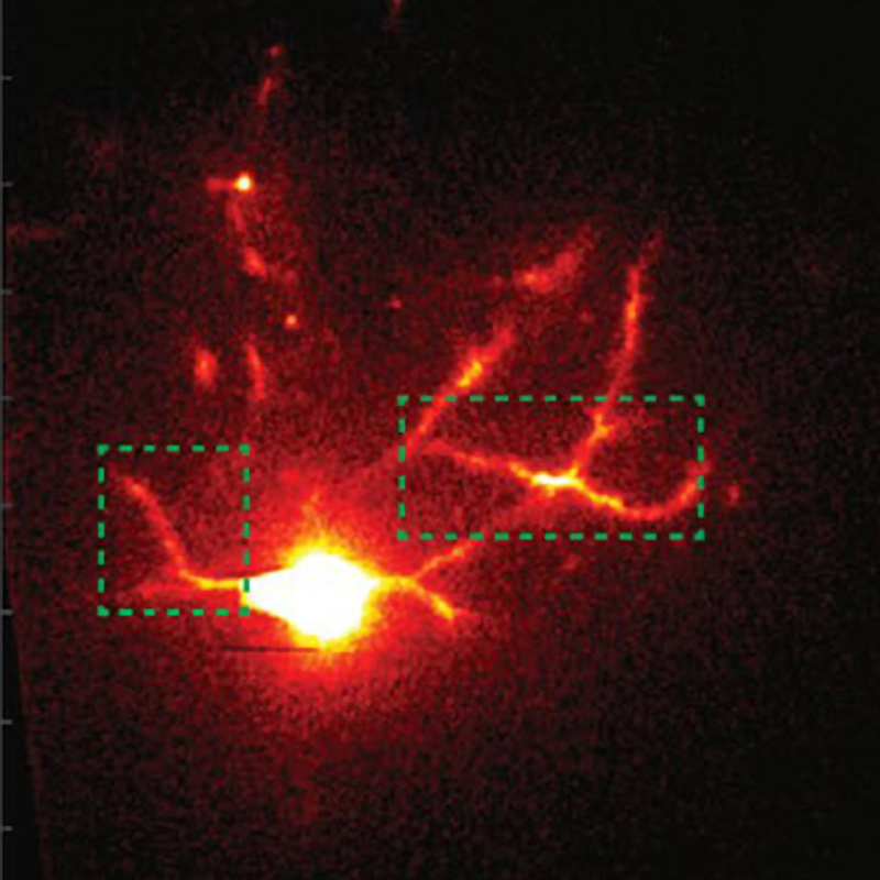 Los ingenieros del MIT utilizan una nueva tecnología de microscopio para observar las sinapsis en el cerebro vivo