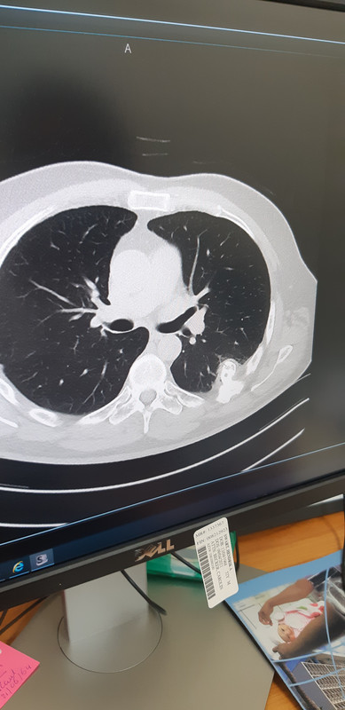 screenshot ct-scan 2