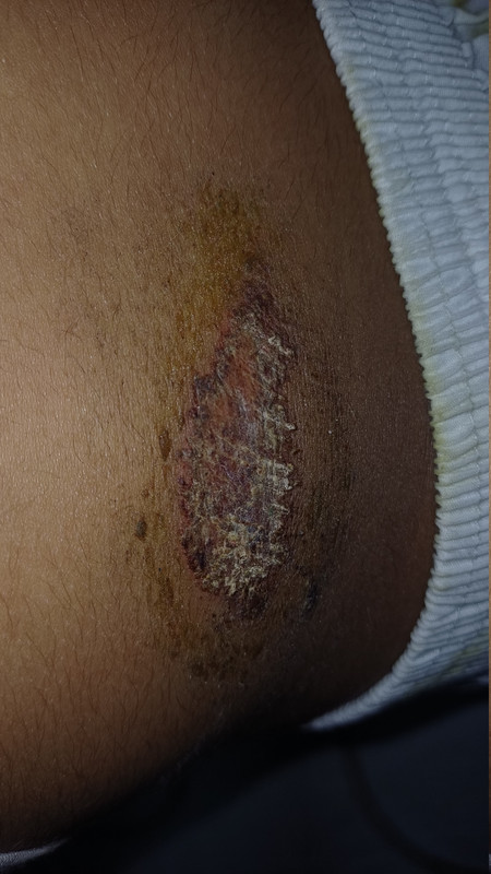 17730691571038013762951084680309