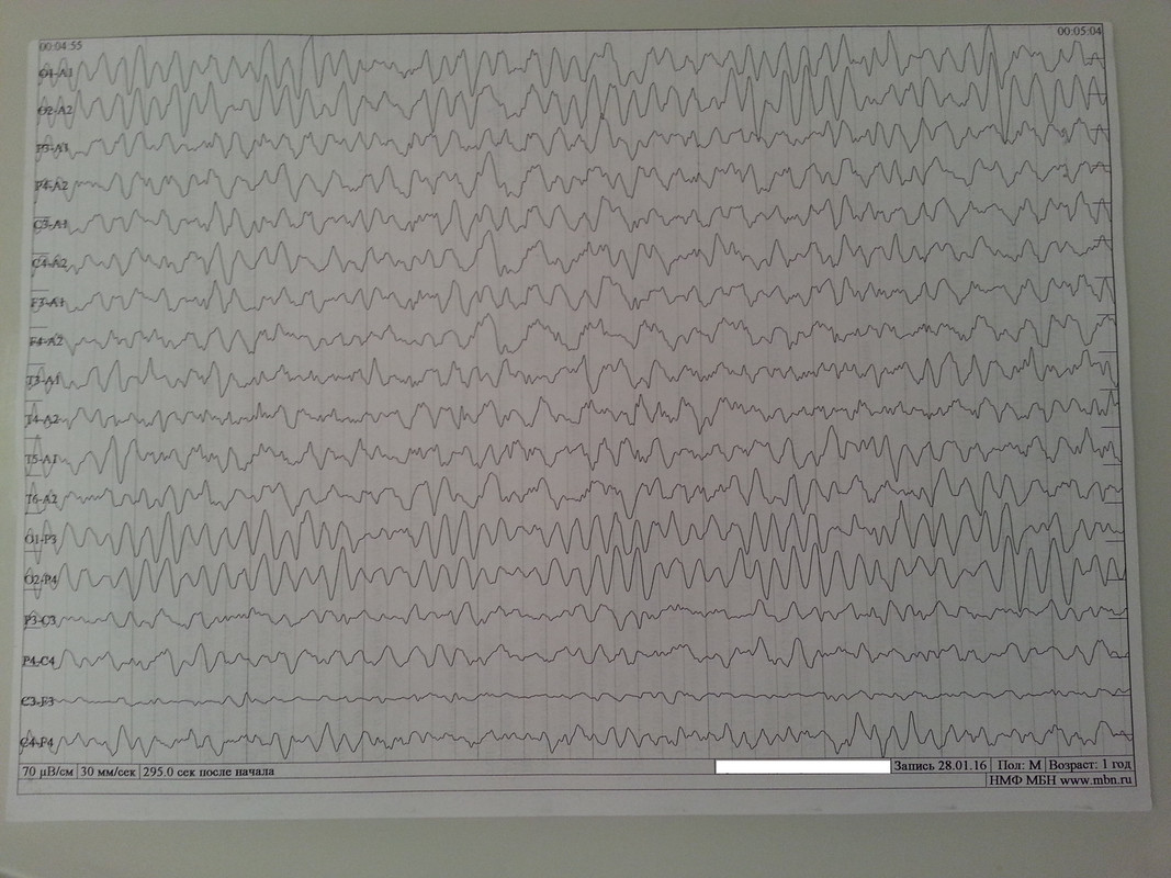 ээг 1 год с.1
