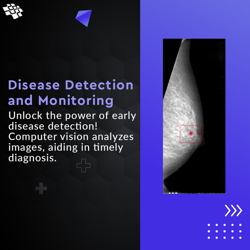 Computer Vision in Healthcare