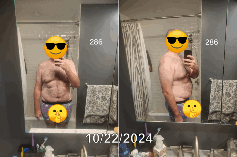 progressphotos front