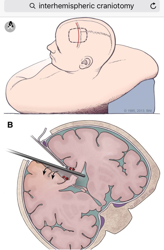 E336AC76-A235-4F43-B9DB-2B6BBB679B72