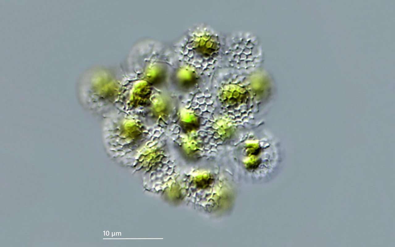 Synura 15 sphagnicola Goldkugel sechseckige Schuppen (abgestorben) DIK 100 Hochmoor Arzmoos-Z7