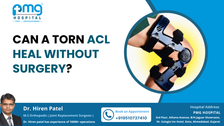 Can a Torn ACL Heal Without Surgery 768x432 (1)111