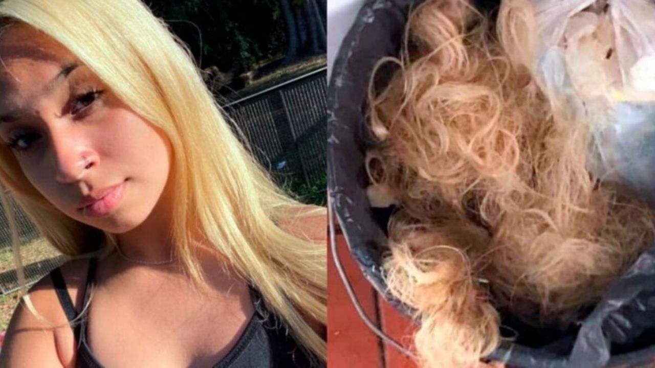 Chica argentina queda calva a dos meses de celebrar su fiesta de quince años