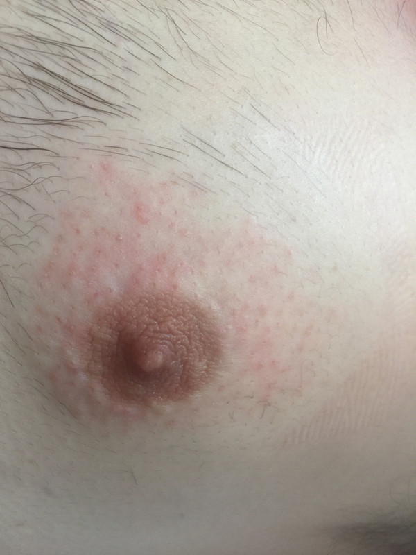 A3D3467B-1BC2-4D94-B7D9-B1D76DF2FFE6